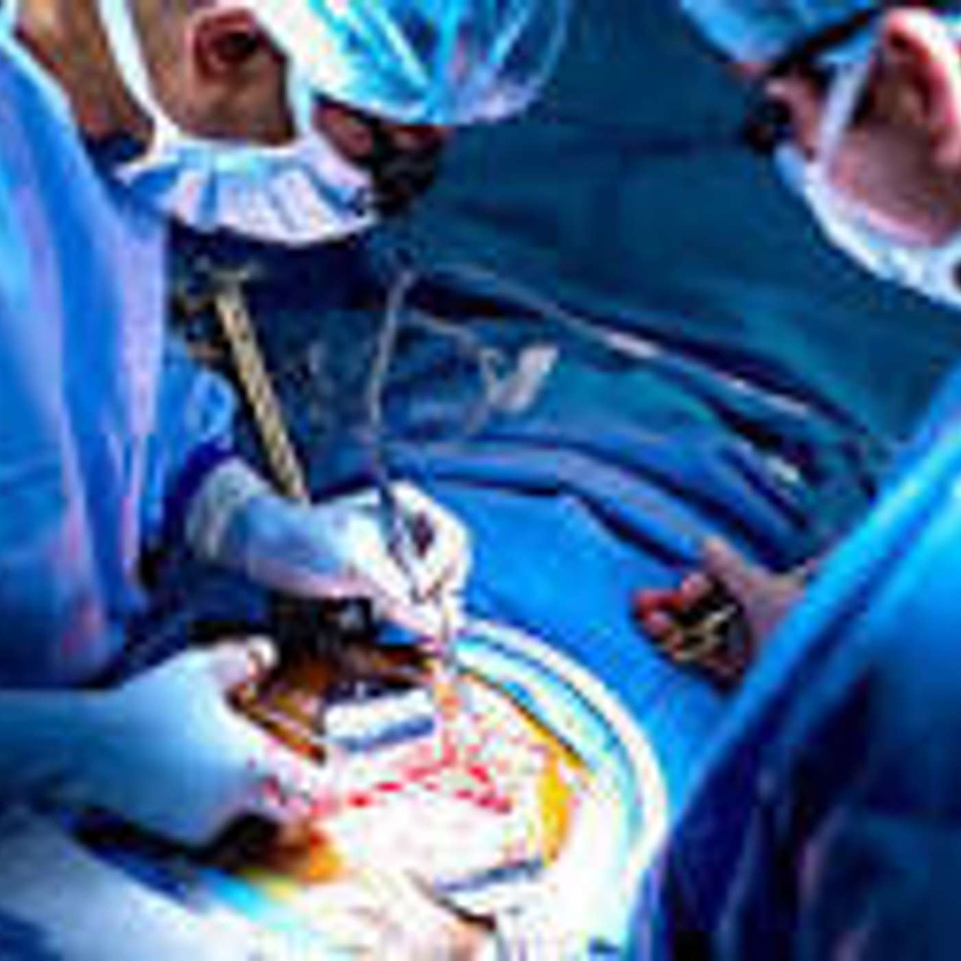 The Amazing Kidney Transplant