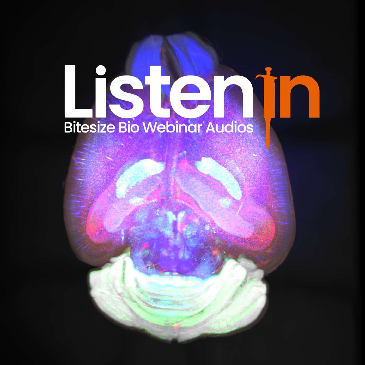 Whole-brain Spatial Transcriptomics at Cellular Resolution