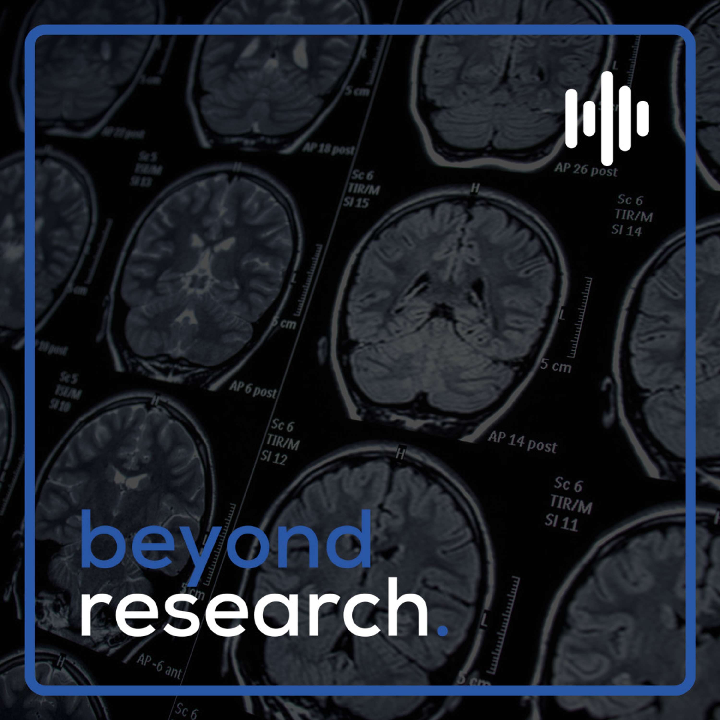 Research Improving Diagnostic Imaging in the ER