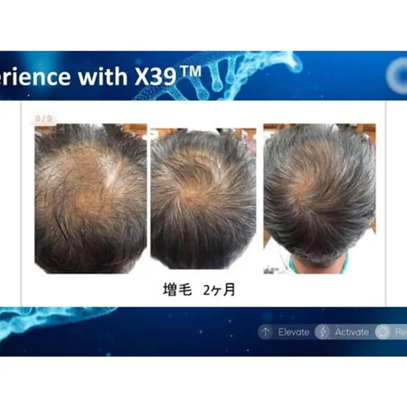 [LifeWave] Natural protocols for thinning hair with Dr. Dennis Part 1