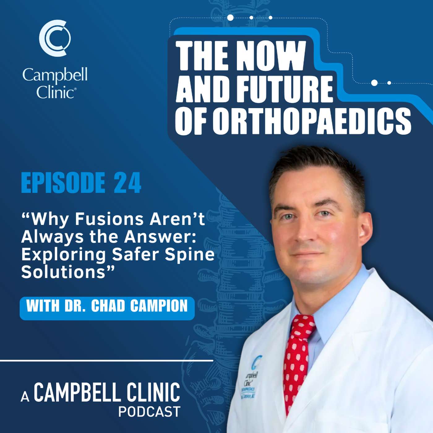 “Why Fusions Aren’t Always the Answer: Exploring Safer Spine Solutions” with Dr. Chad Campion