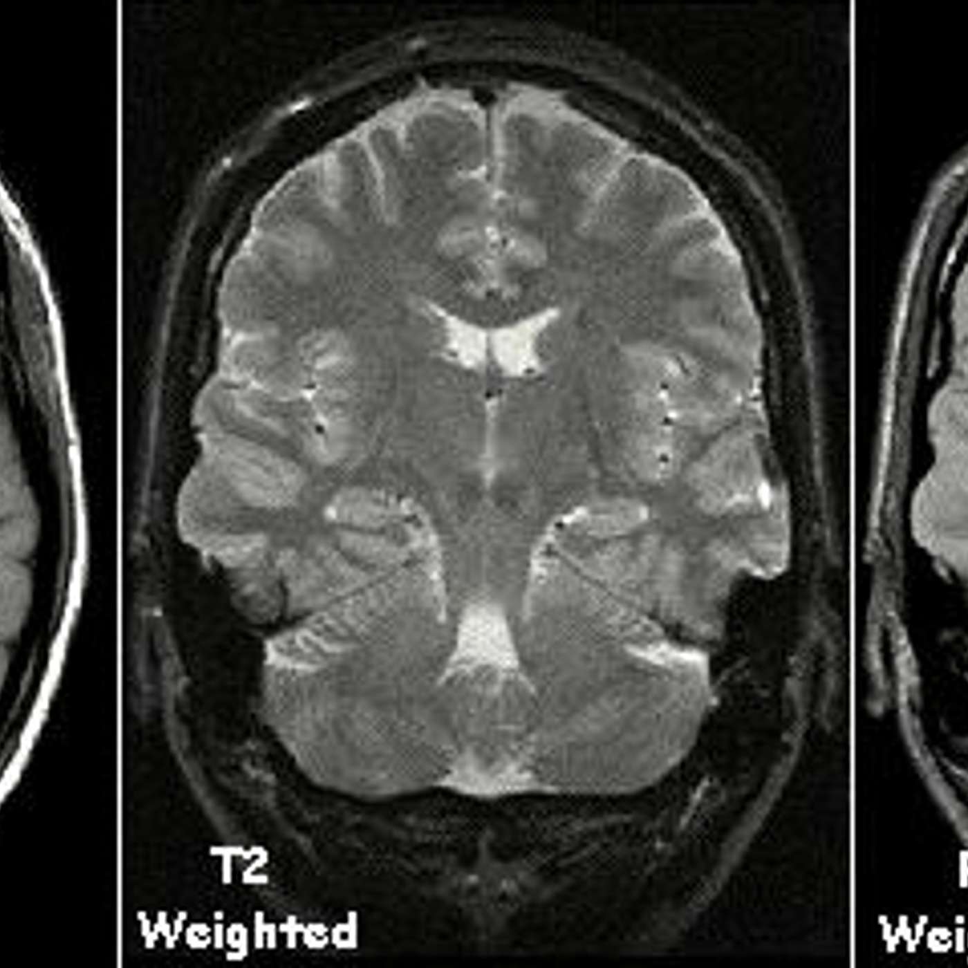 Can You Open Medical Data (MR, CT, X-Ray) in Python and Find Tumors With AI?! Maybe