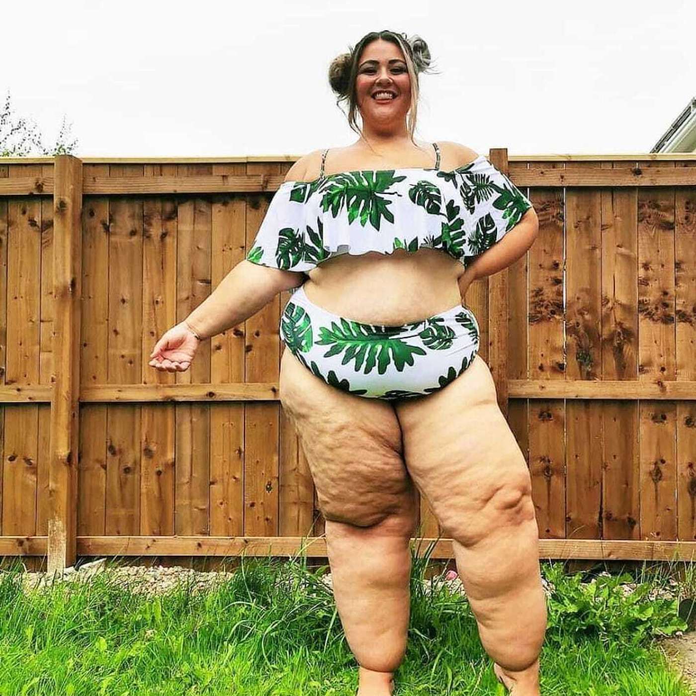 #8: Zoe Pearce - Living with Lipoedema