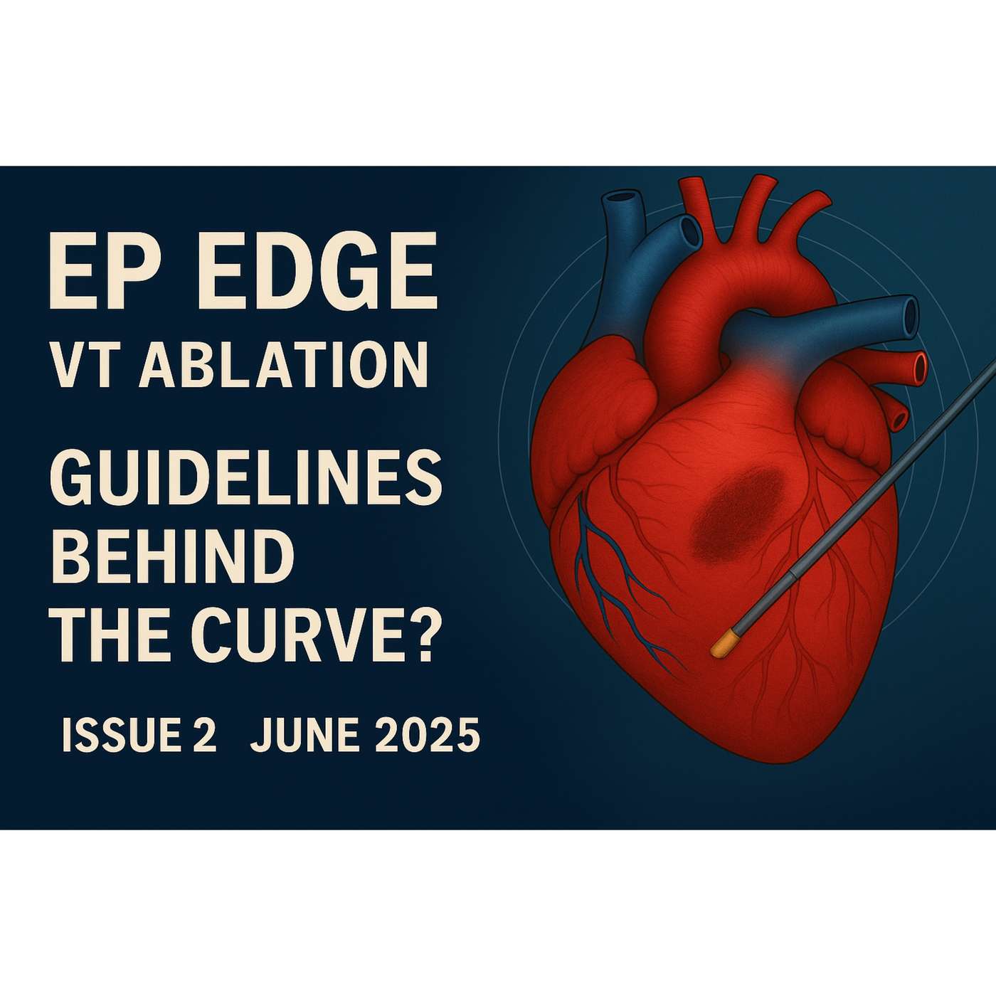 First-Line VT Ablation: Trials, Tools & Timing: EP Edge Newsletter June 2025 First-Line VT Ablation: Trials, Tools & Timing: EP Edge Newsletter June 2025