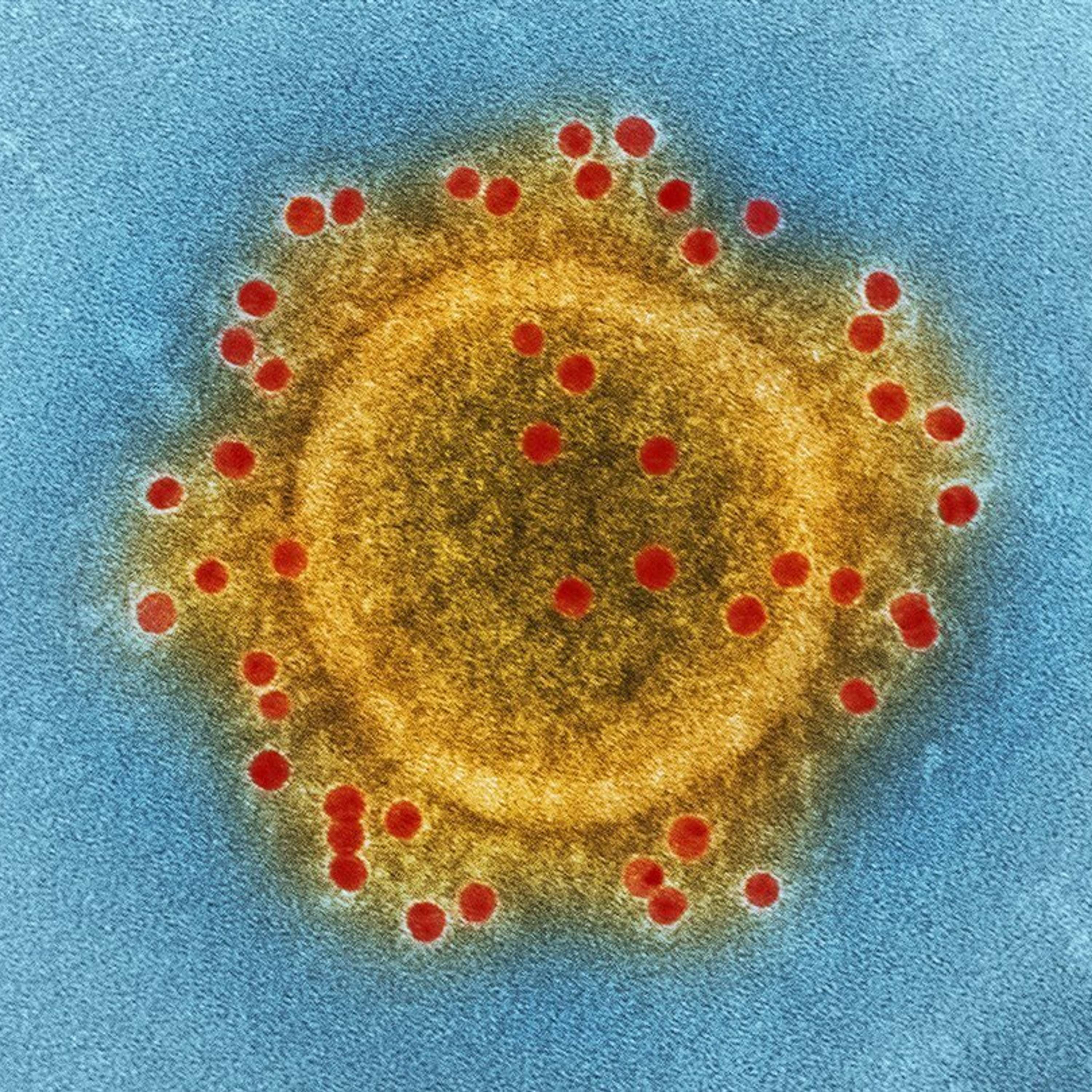 Virus, epidemias y salud (II): Virus y salud