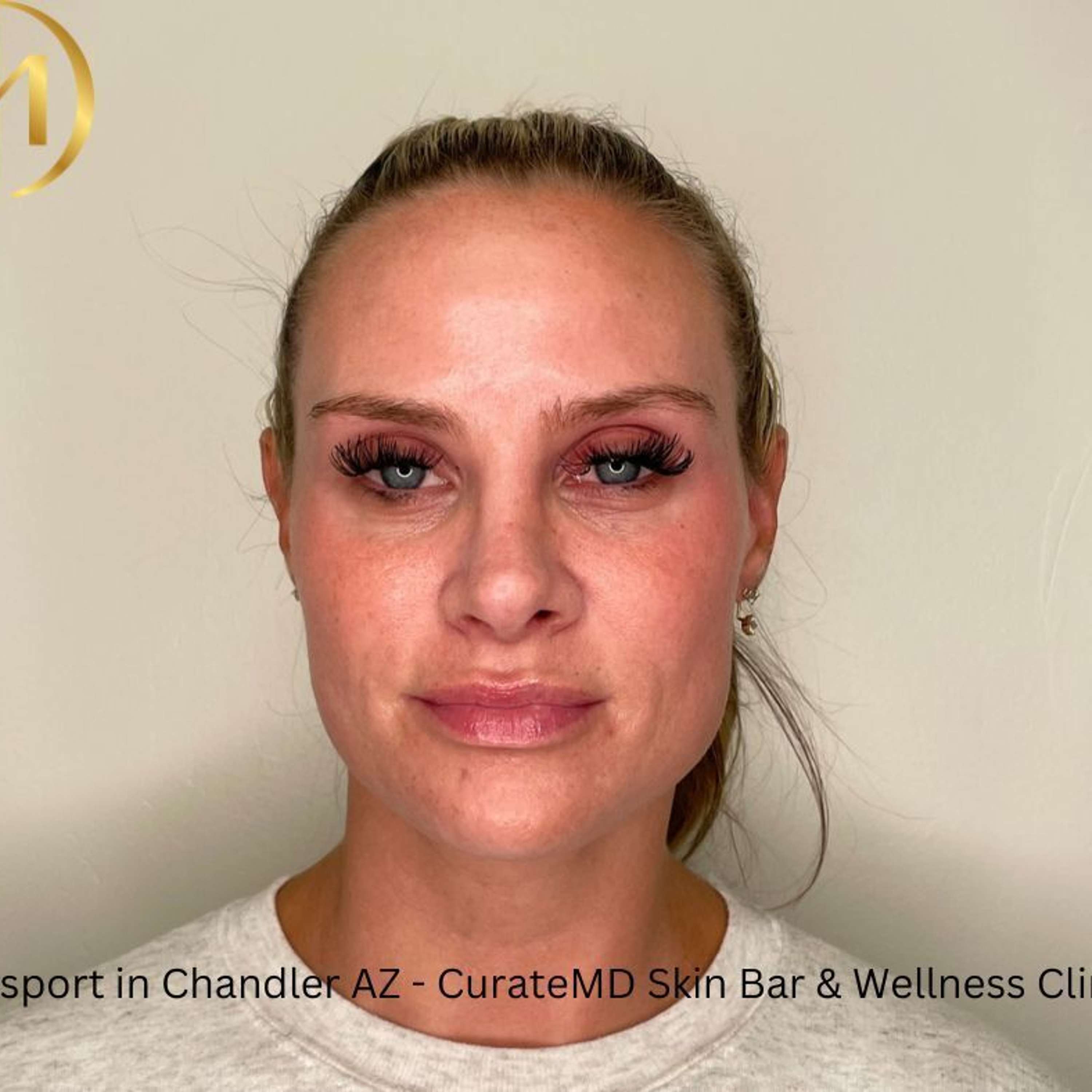 CurateMD Skin Bar and Wellness Clinic