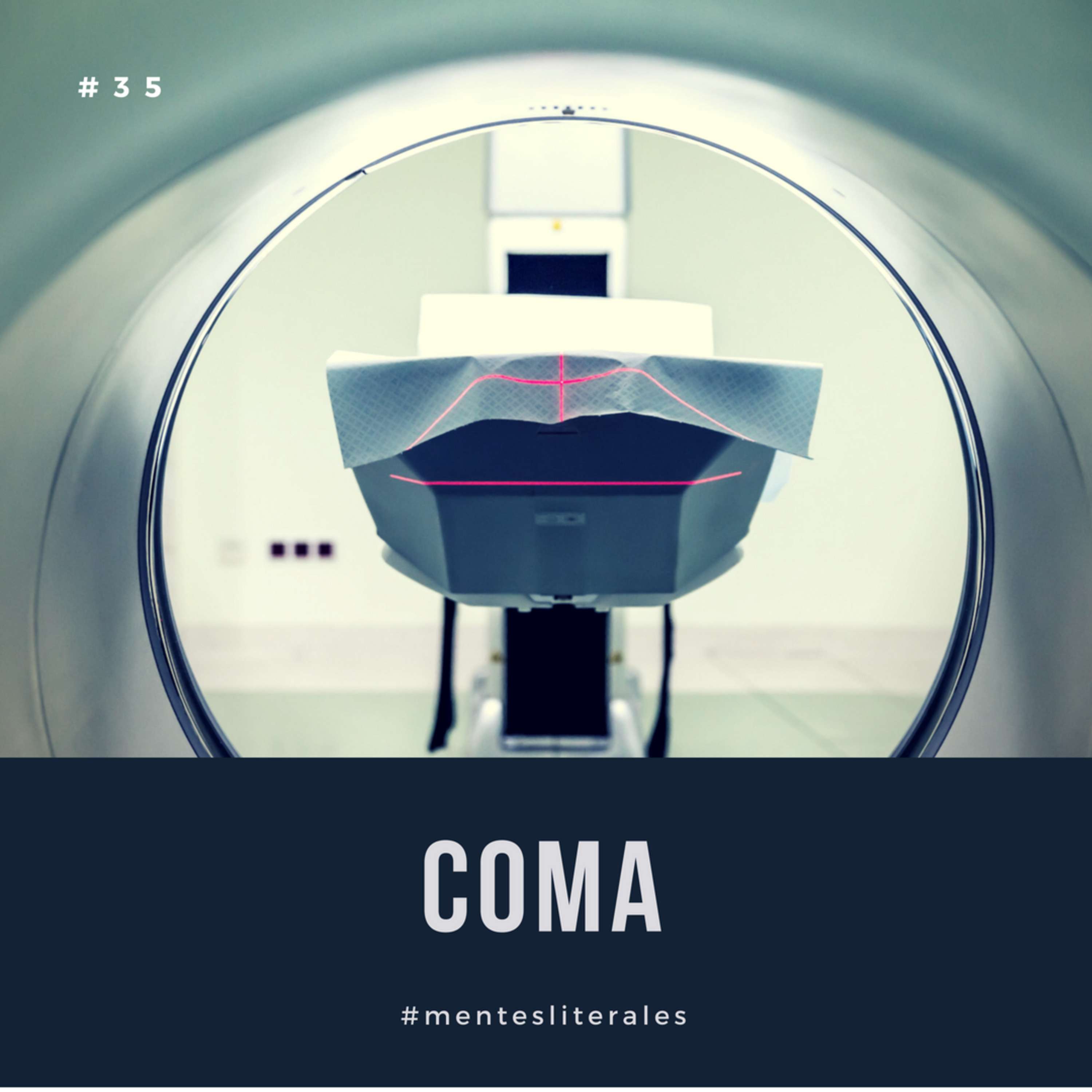 Coma