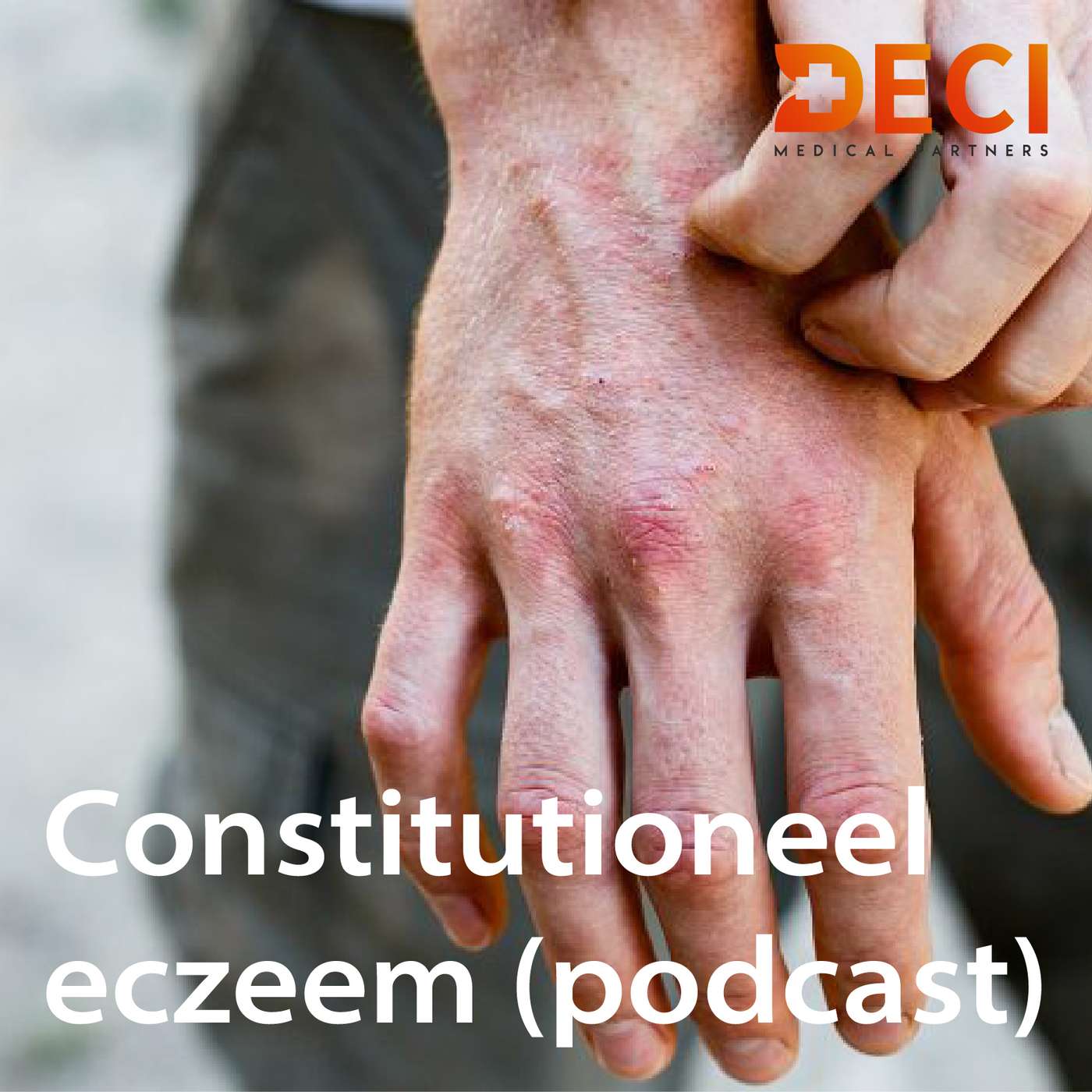 Constitutioneel eczeem