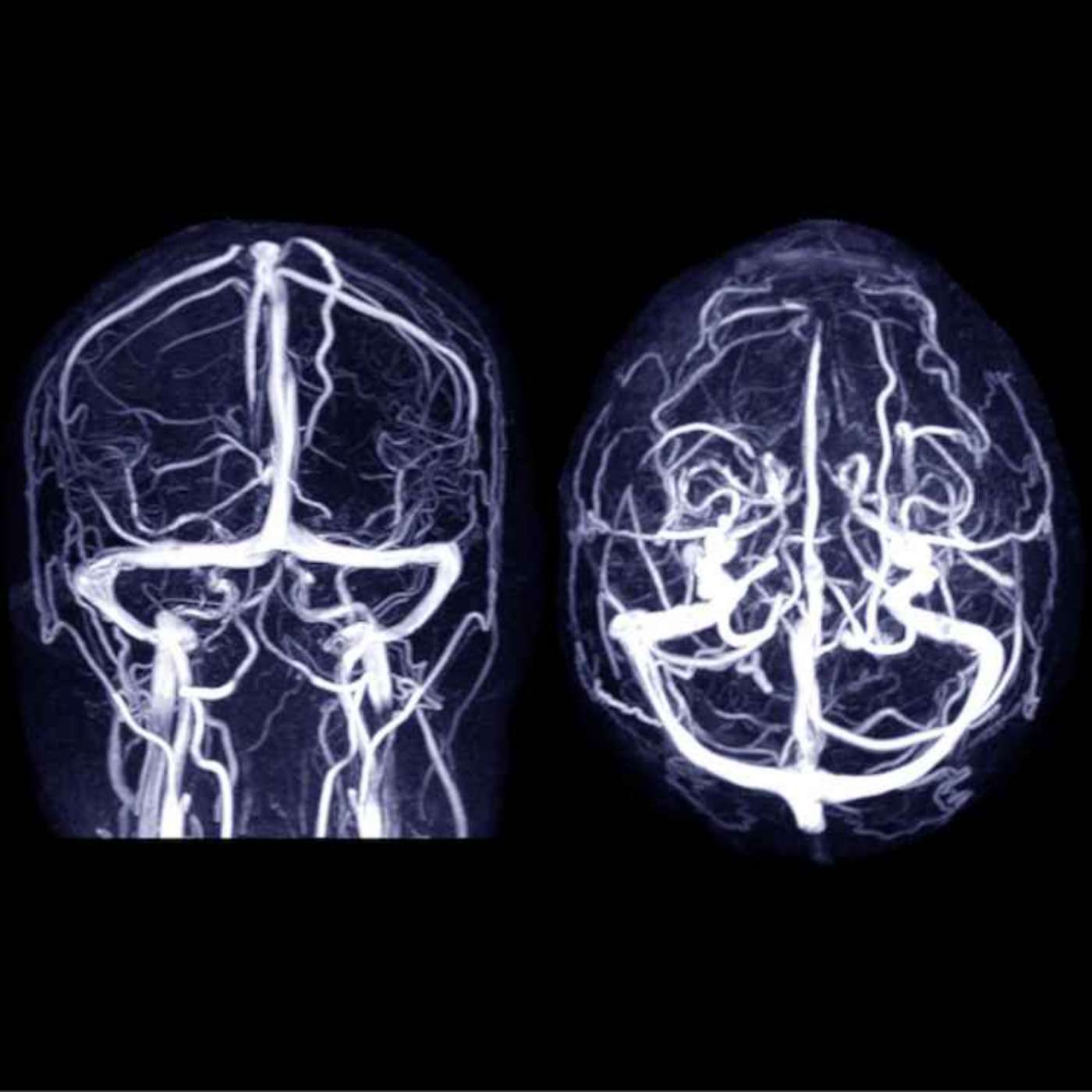 Vaccins Covid et thrombose : analyse et recommandations pratiques episode artwork