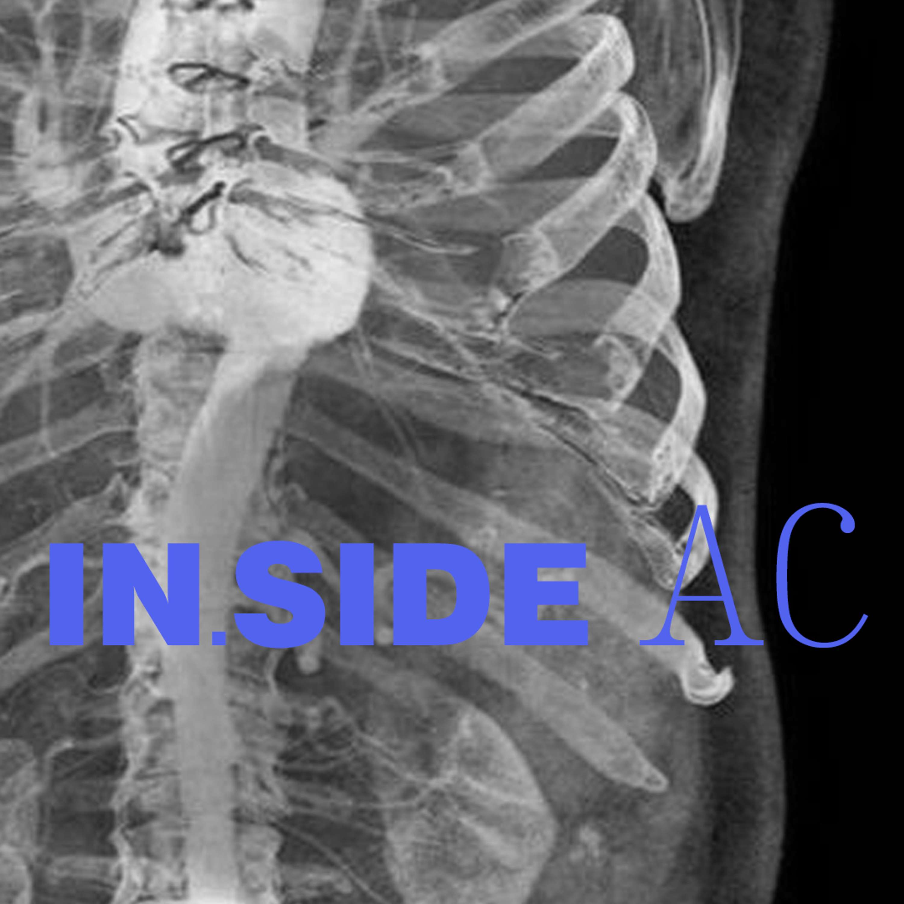 IN.SIDE AC