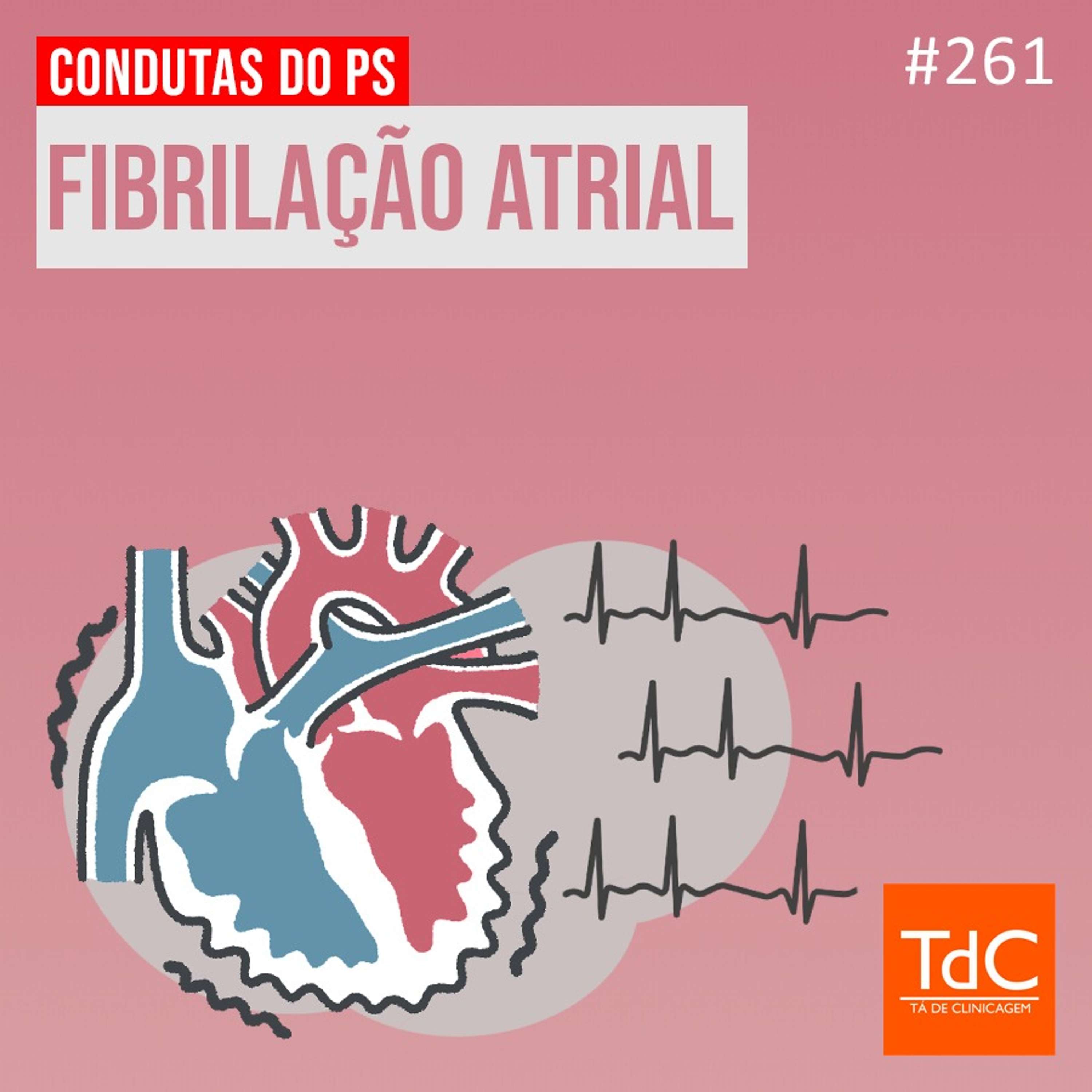 TdC 261: Fibrilação atrial - Condutas no pronto-socorro