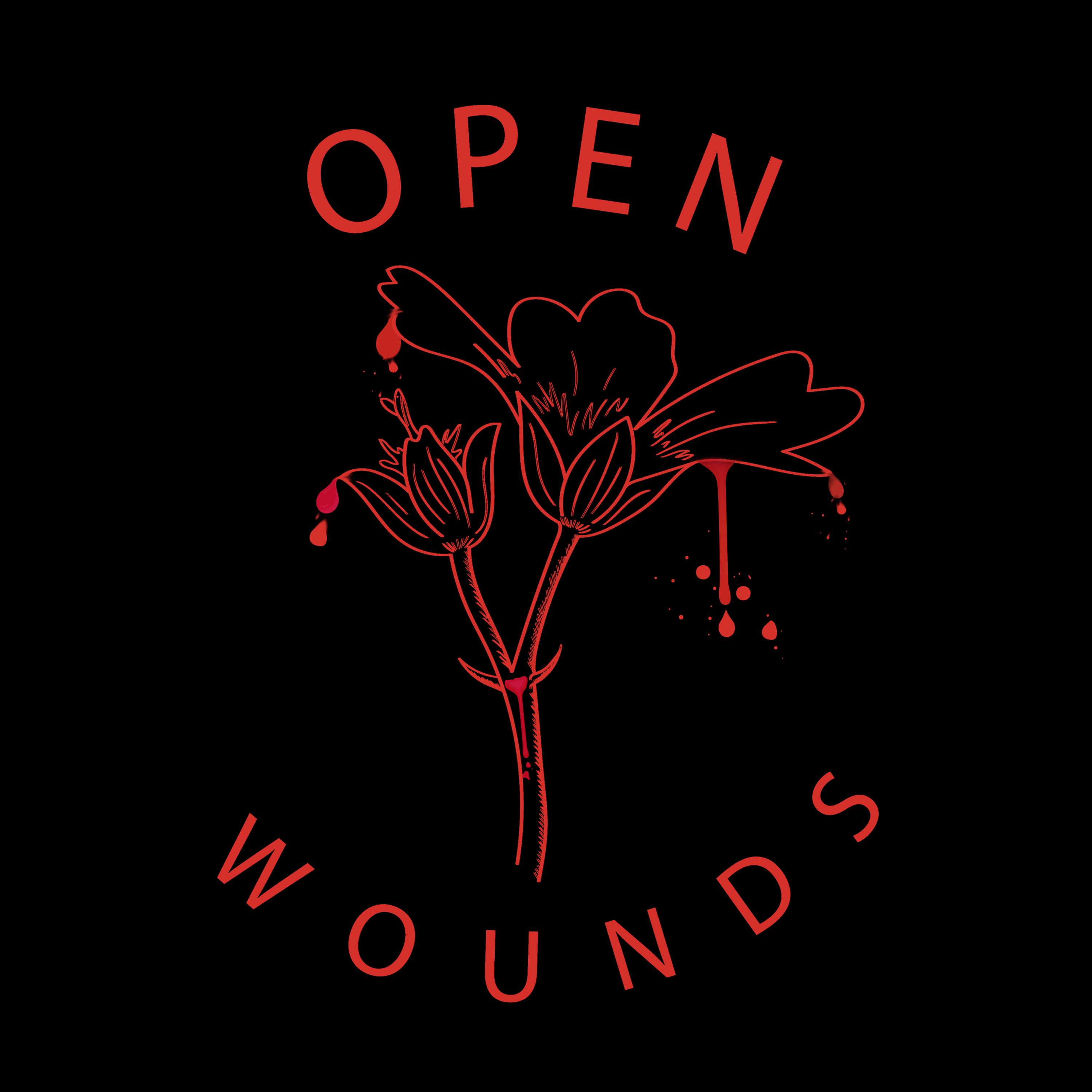 Open Wounds