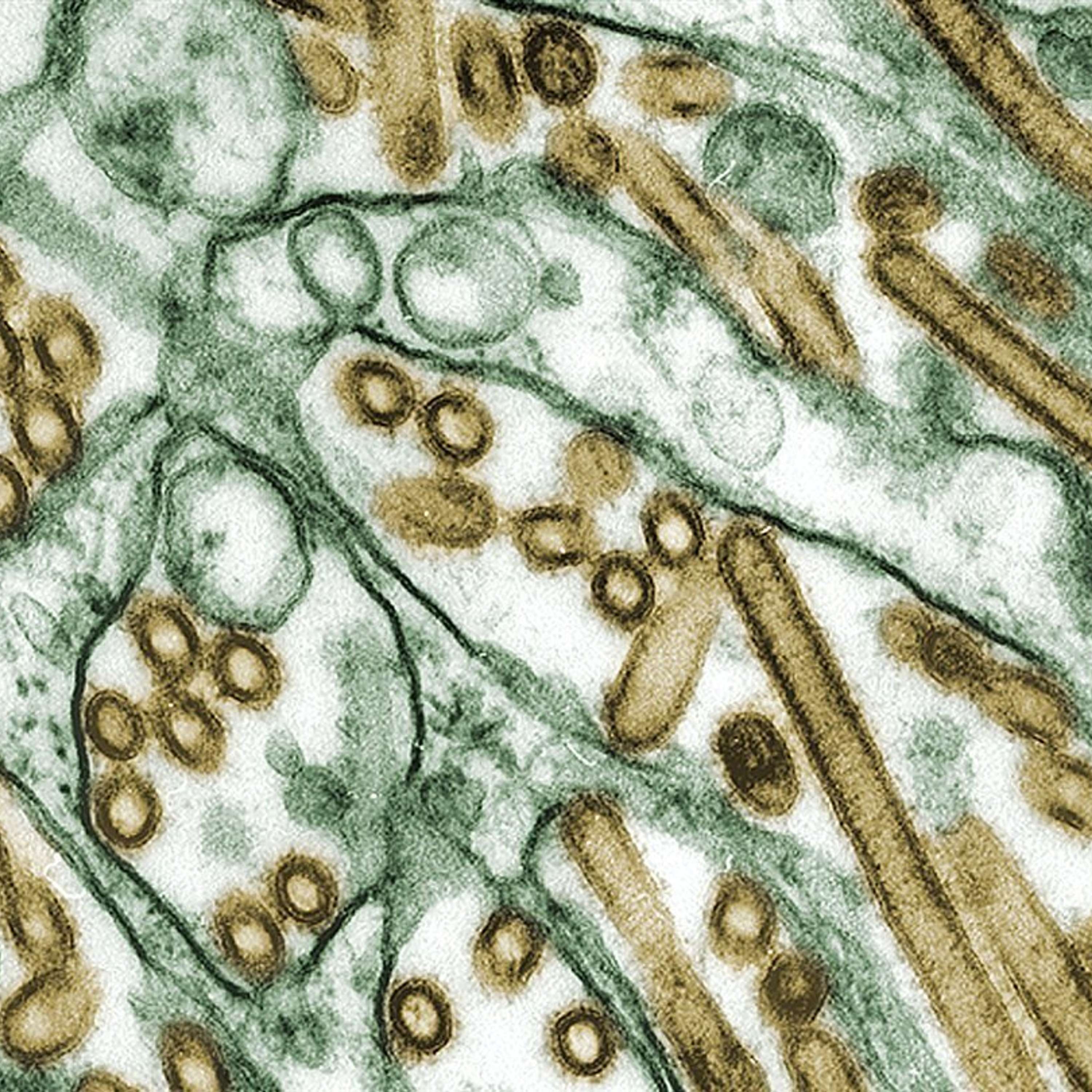 Virus, epidemias y salud (I): Virus y epidemias