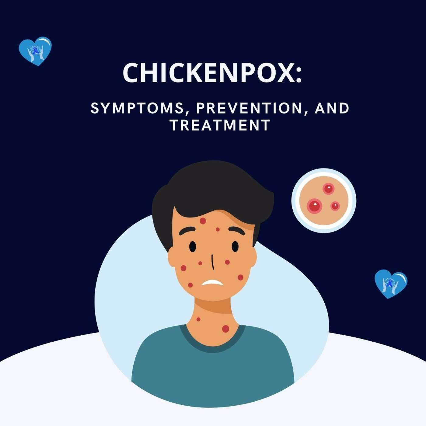 Chickenpox: Symptoms, Prevention, and Treatment