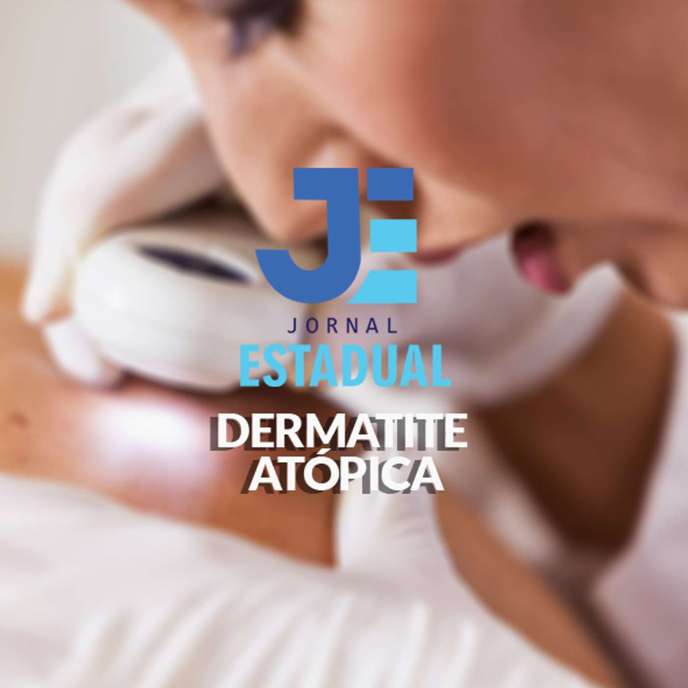 Matéria - Dermatite Atópica episode artwork