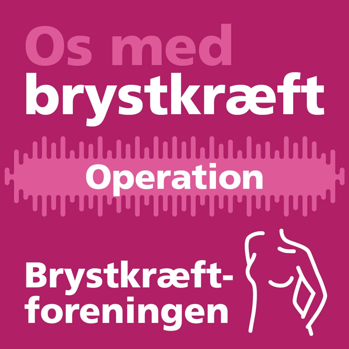 Os med brystkræft - en podcast af Brystkræftforeningen