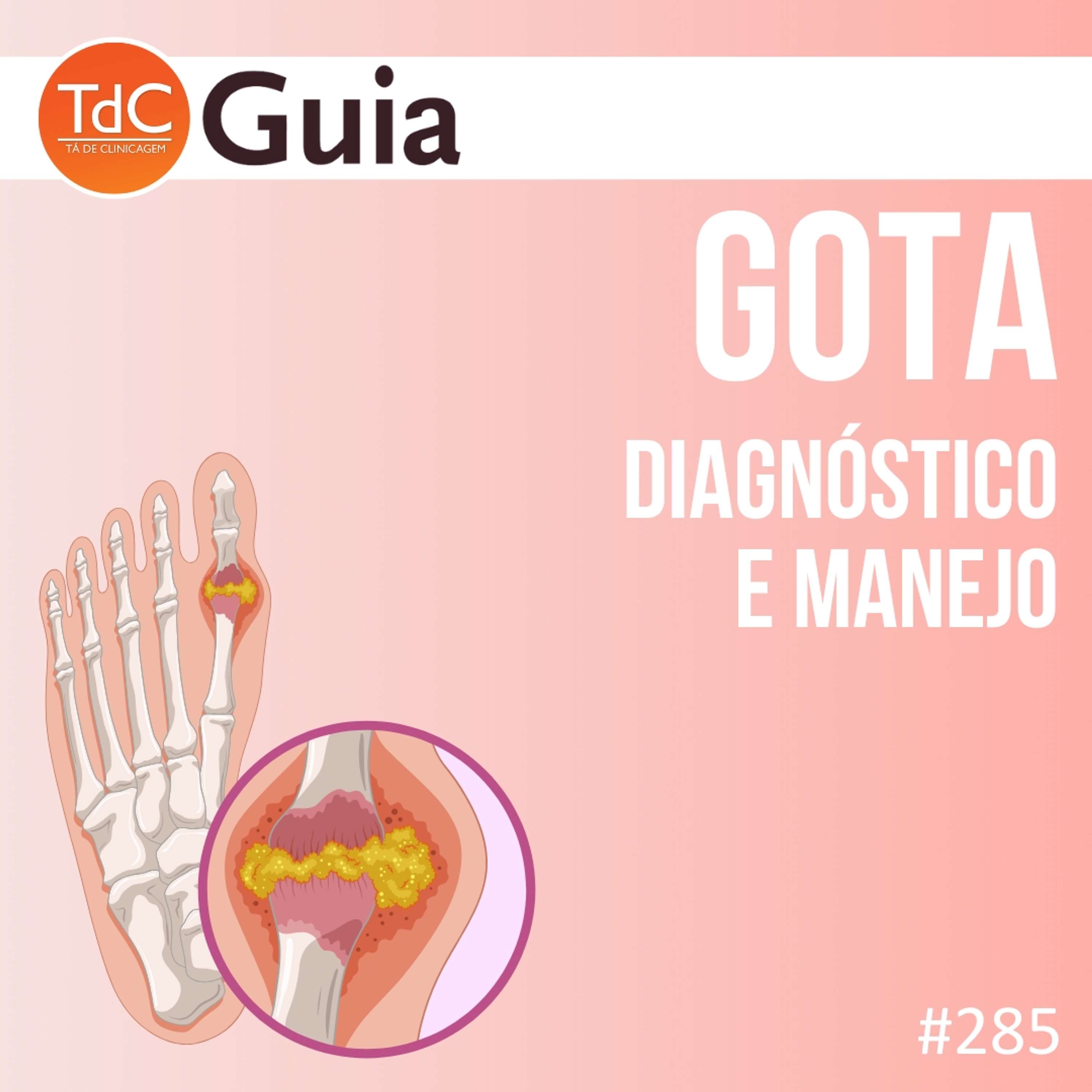 TdC 285: Gota - Diagnóstico e tratamento