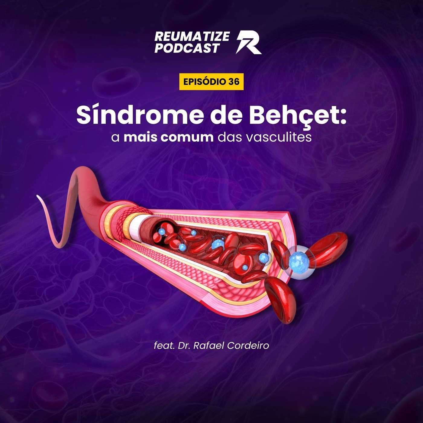 Reumatize