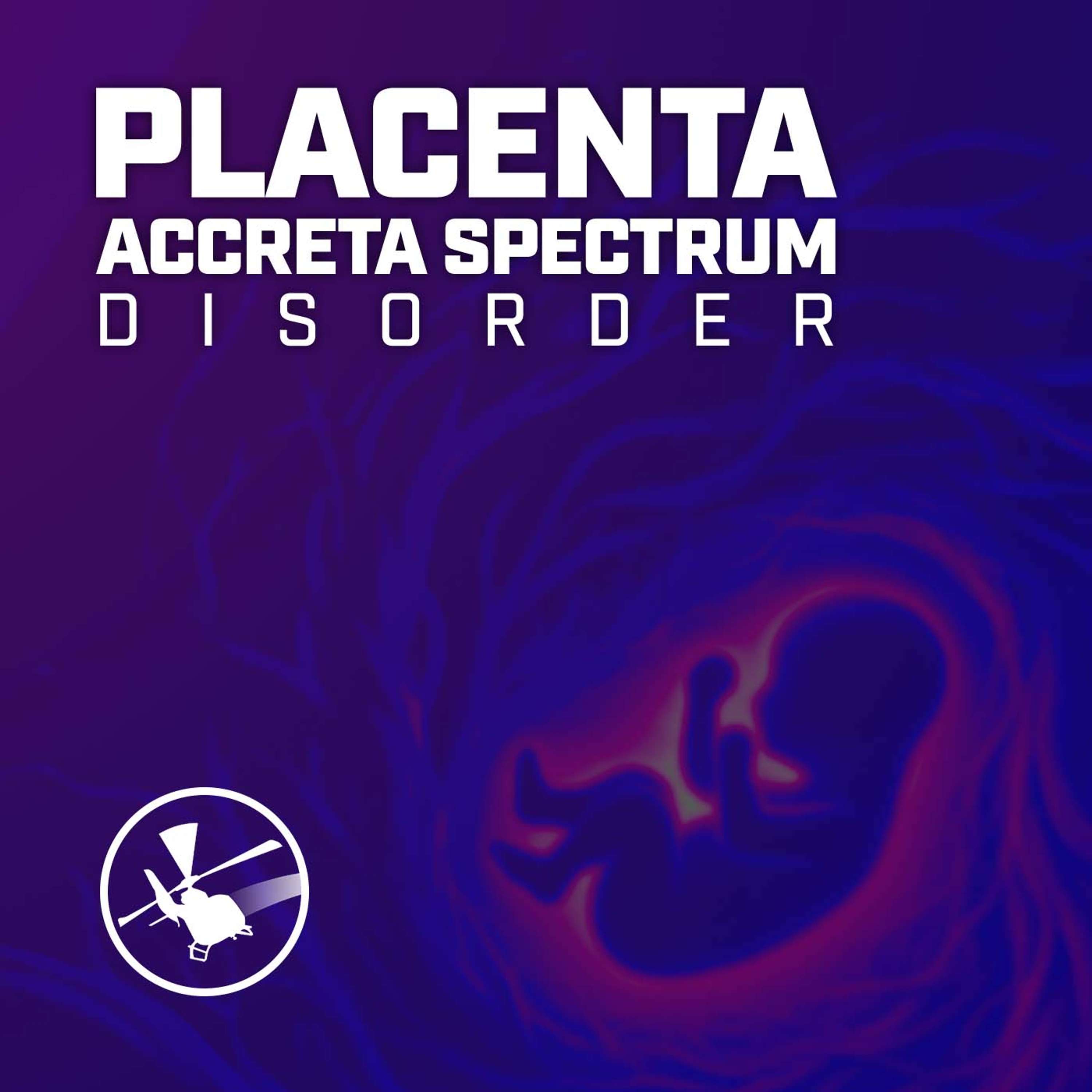 MDCAST: Placenta Accreta Spectrum Disorder