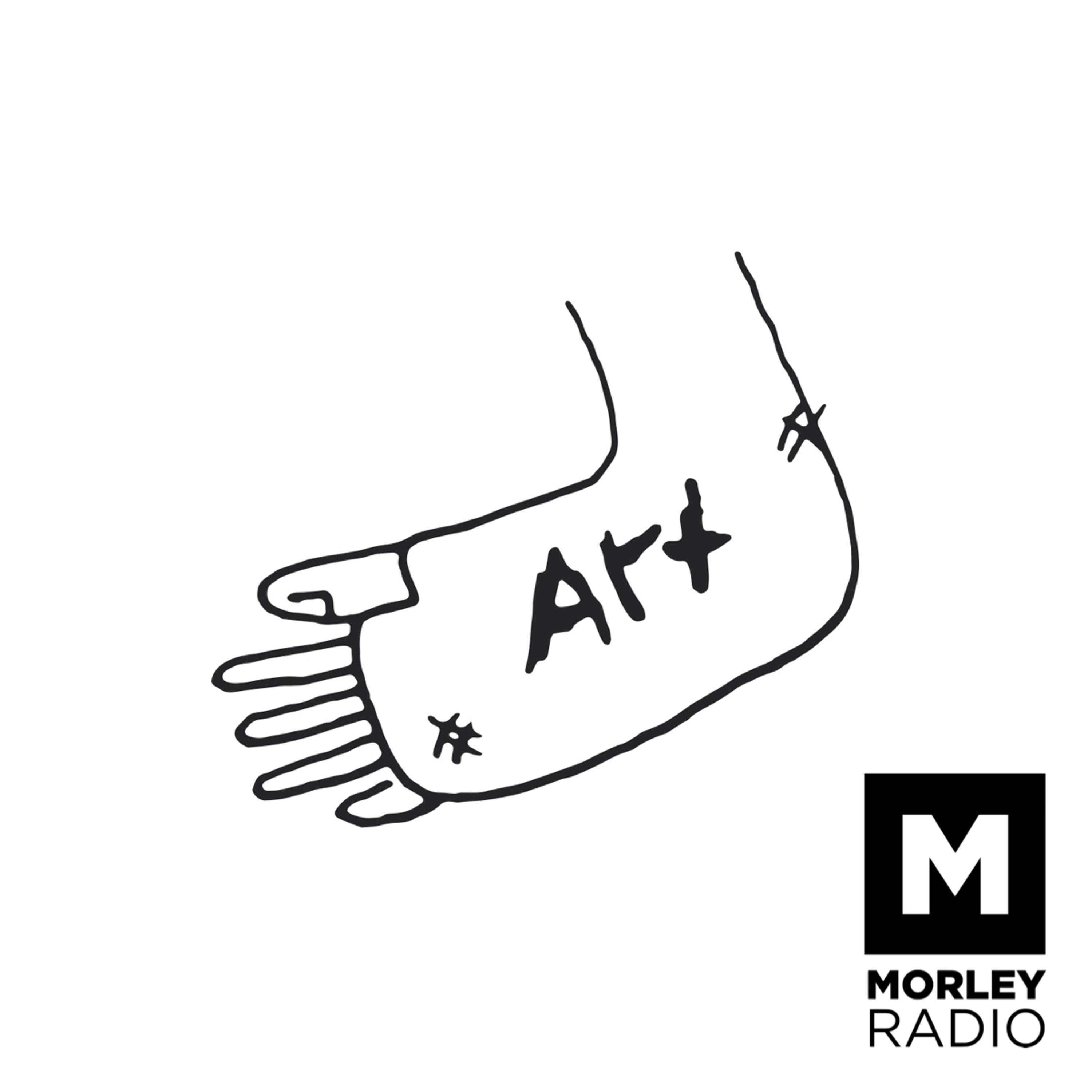 Art Cast