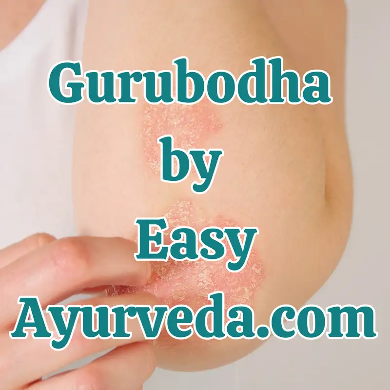 Gurubodha 117: Case Study by Dr MB Gururaja – Eczema Ayurveda Treatment | Hazards of Hormonal Birth Control Pills