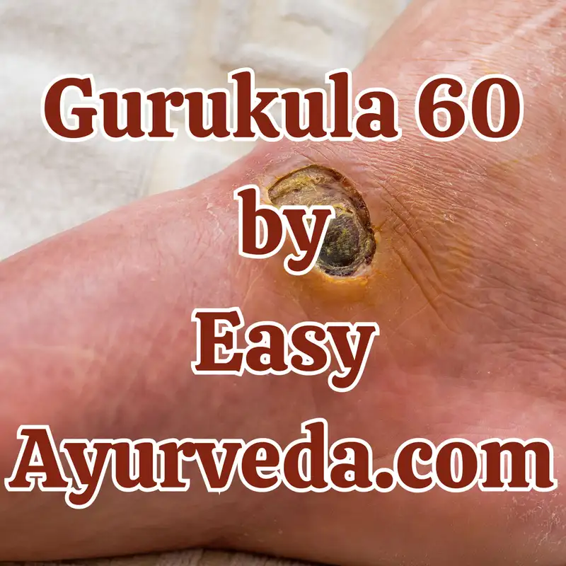 Gurukula 60: “Dhoopana Karma in Dushta Vrana”