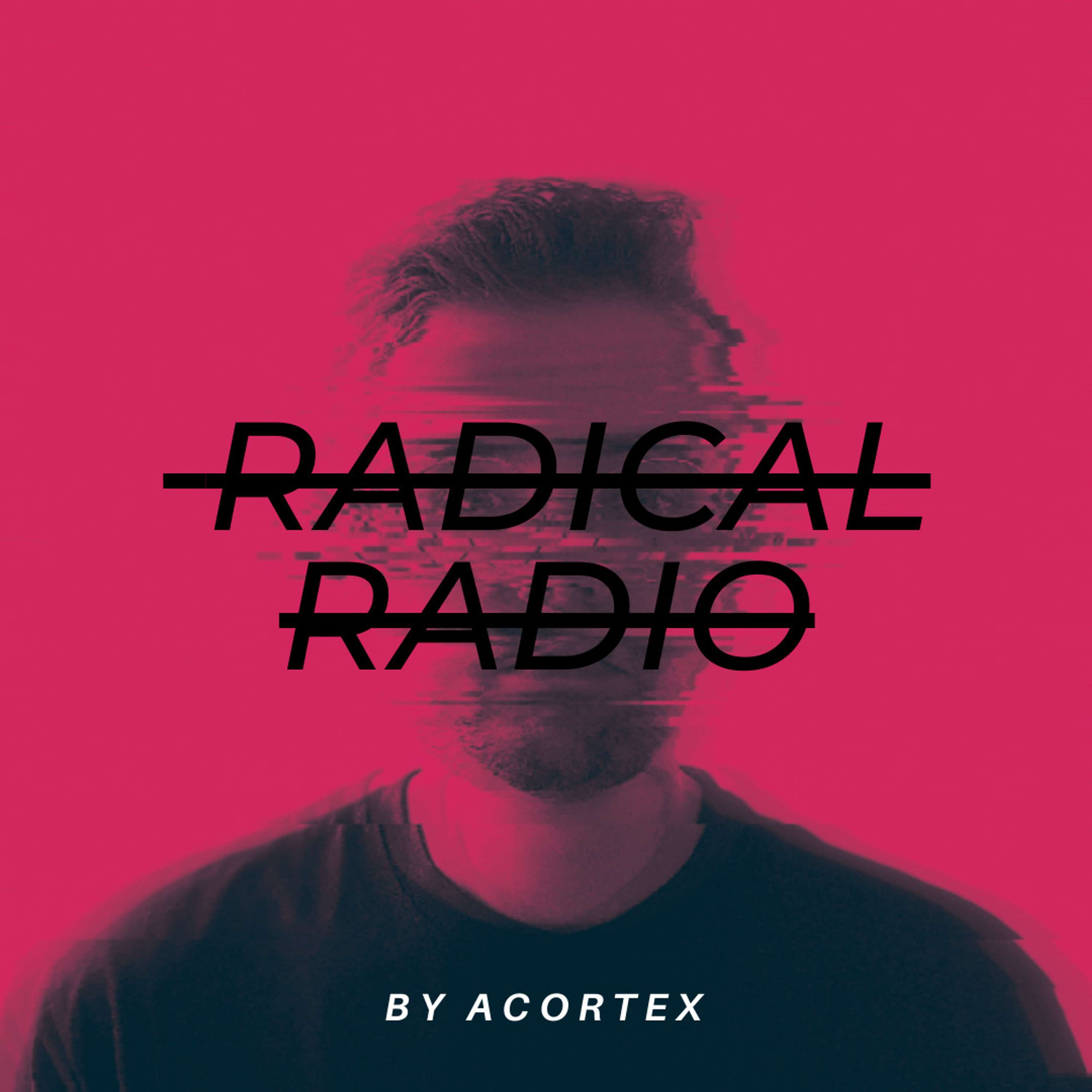 Radical Radio #003 (With Guestmix Robin Nap)