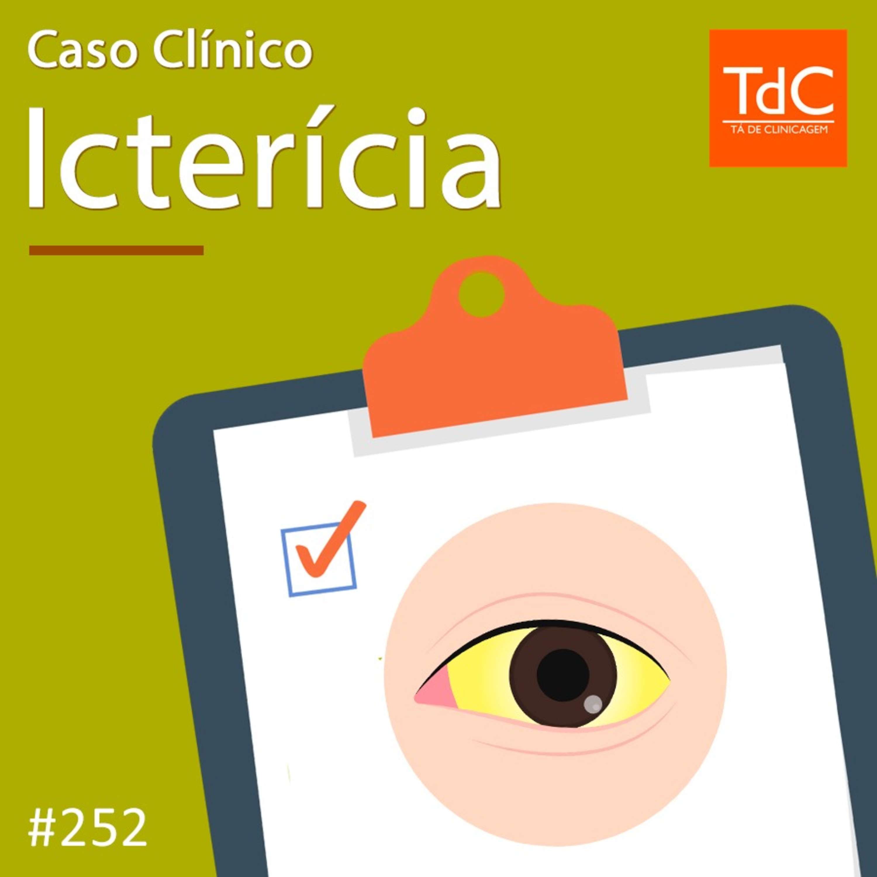 TdC 252: Caso Clínico de Icterícia