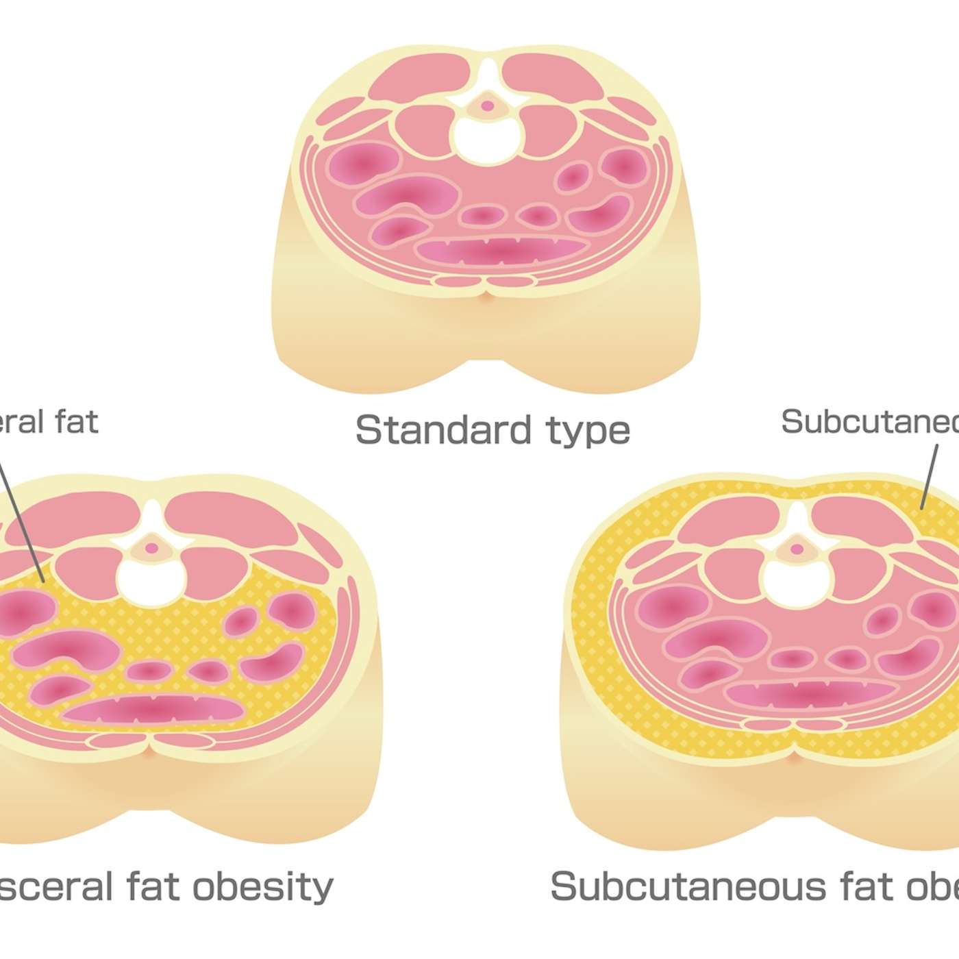 How to Lose Visceral Adipose Tissue (VAT) and Improve Metabolic Health: A Guide to Sustainable Weight Loss episode artwork