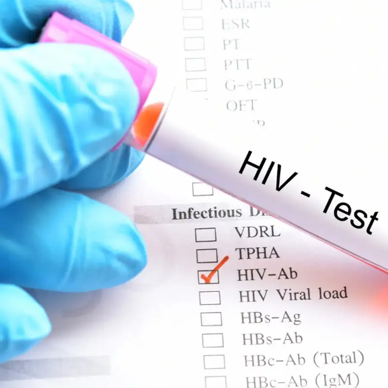 VIH/SIDA : une personne sur 120 est infectée en Ontario