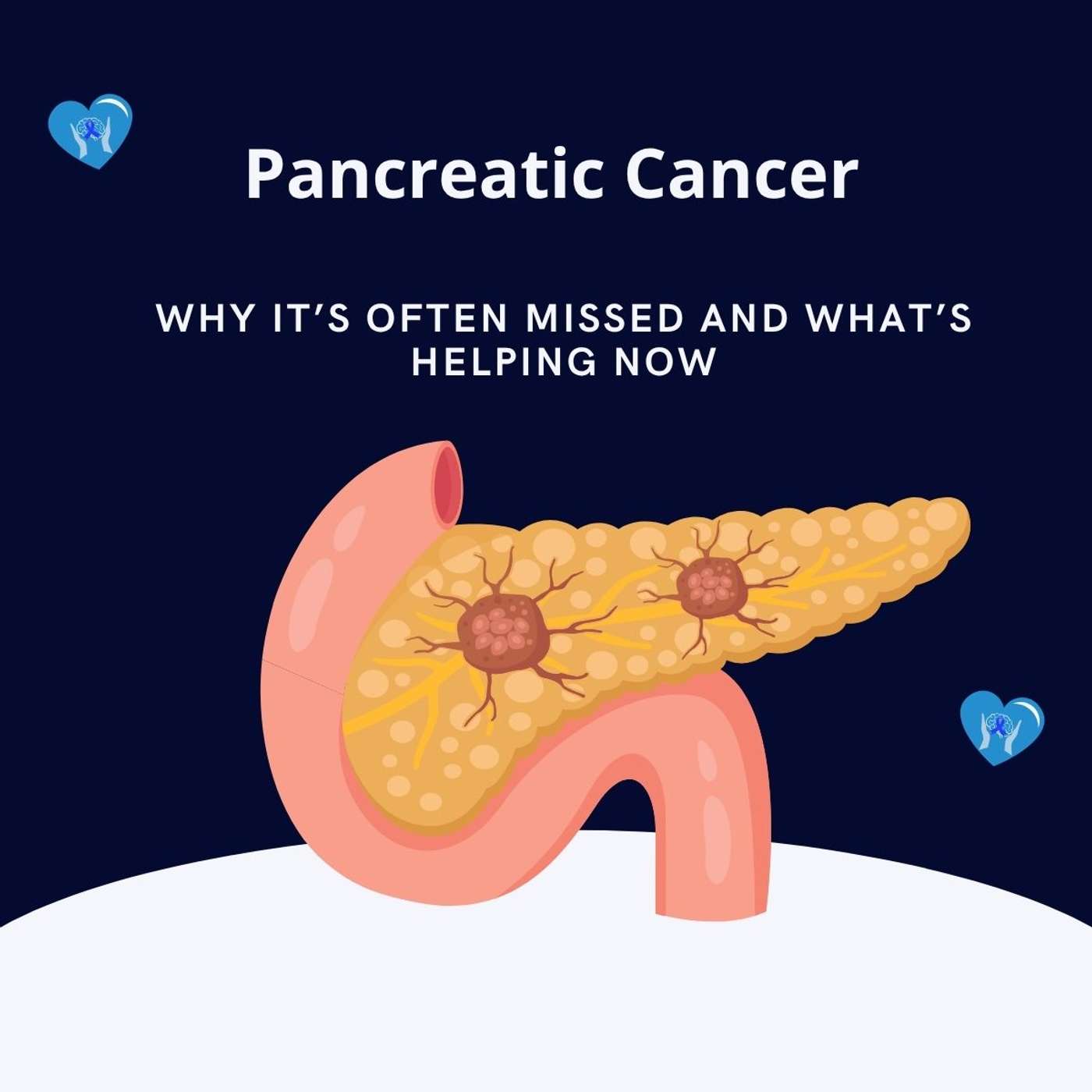 Pancreatic Cancer: Why It’s Often Missed and What’s Helping Now