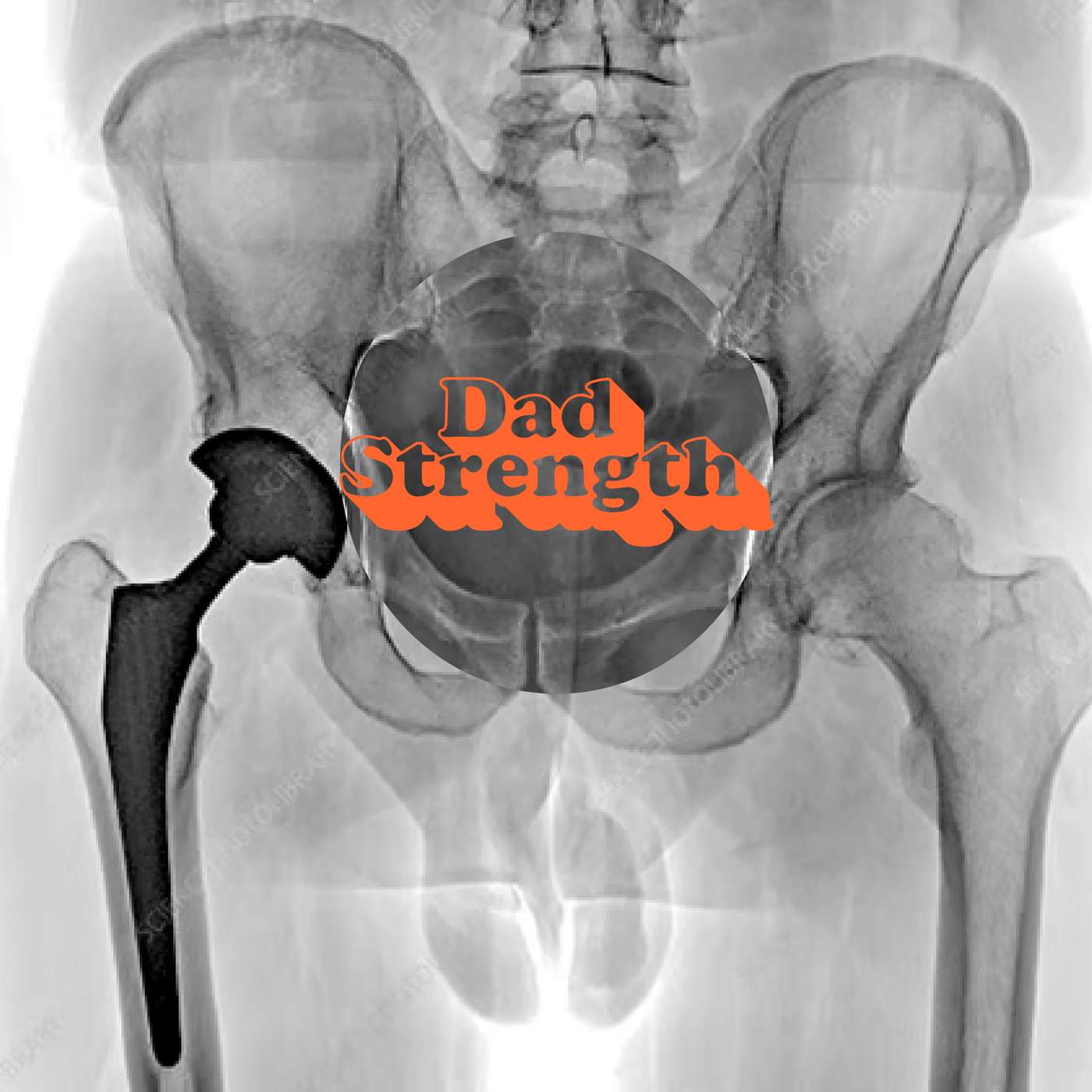 Se.03 Ep. 31: Getting hip: Can you prevent hip replacement surgery?