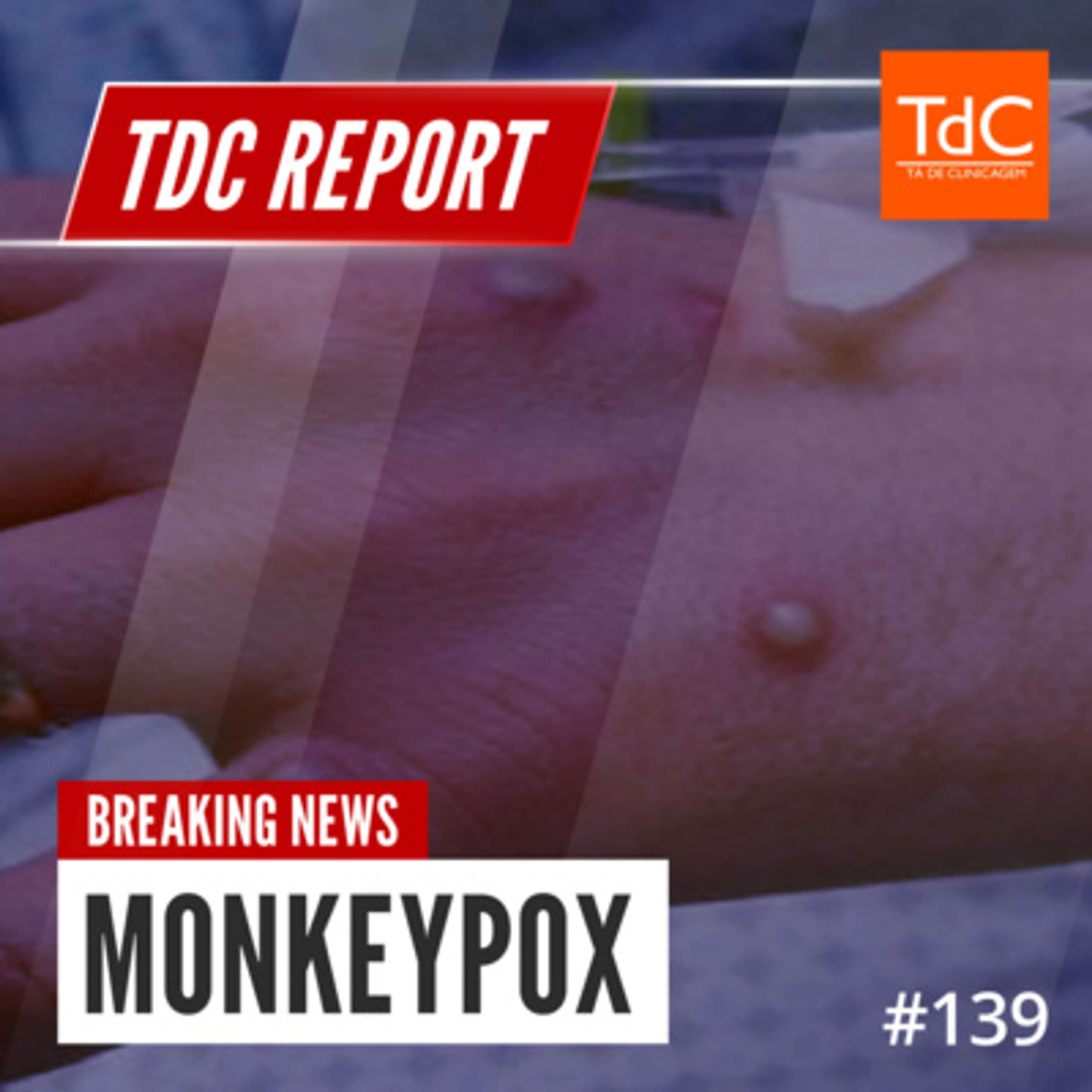 Episódio 139: TdC Report - MonkeyPox