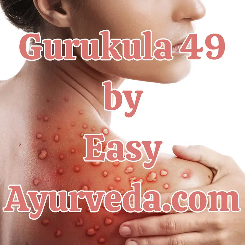 Gurukula 49: Ayurvedic Management of Pityriasis Lichenoides (PLEVA): Comprehensive Case Study Analysis and Therapeutic Insights