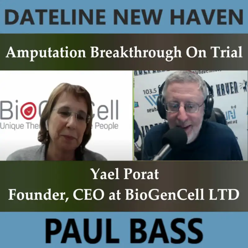 Dateline New Haven: Amputation Breakthrough On Trial