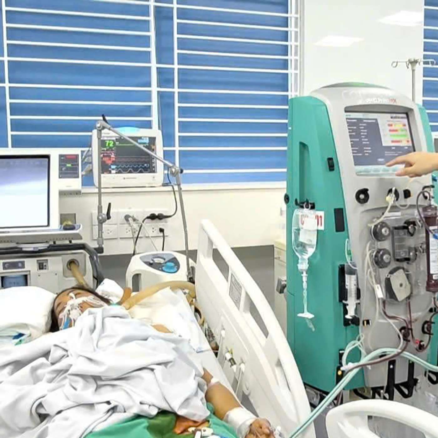 #878 - Suy đa tạng vì loại khuẩn lây lan mạnh trong mùa bão lũ #878 - Suy đa tạng vì loại khuẩn lây lan mạnh trong mùa bão lũ