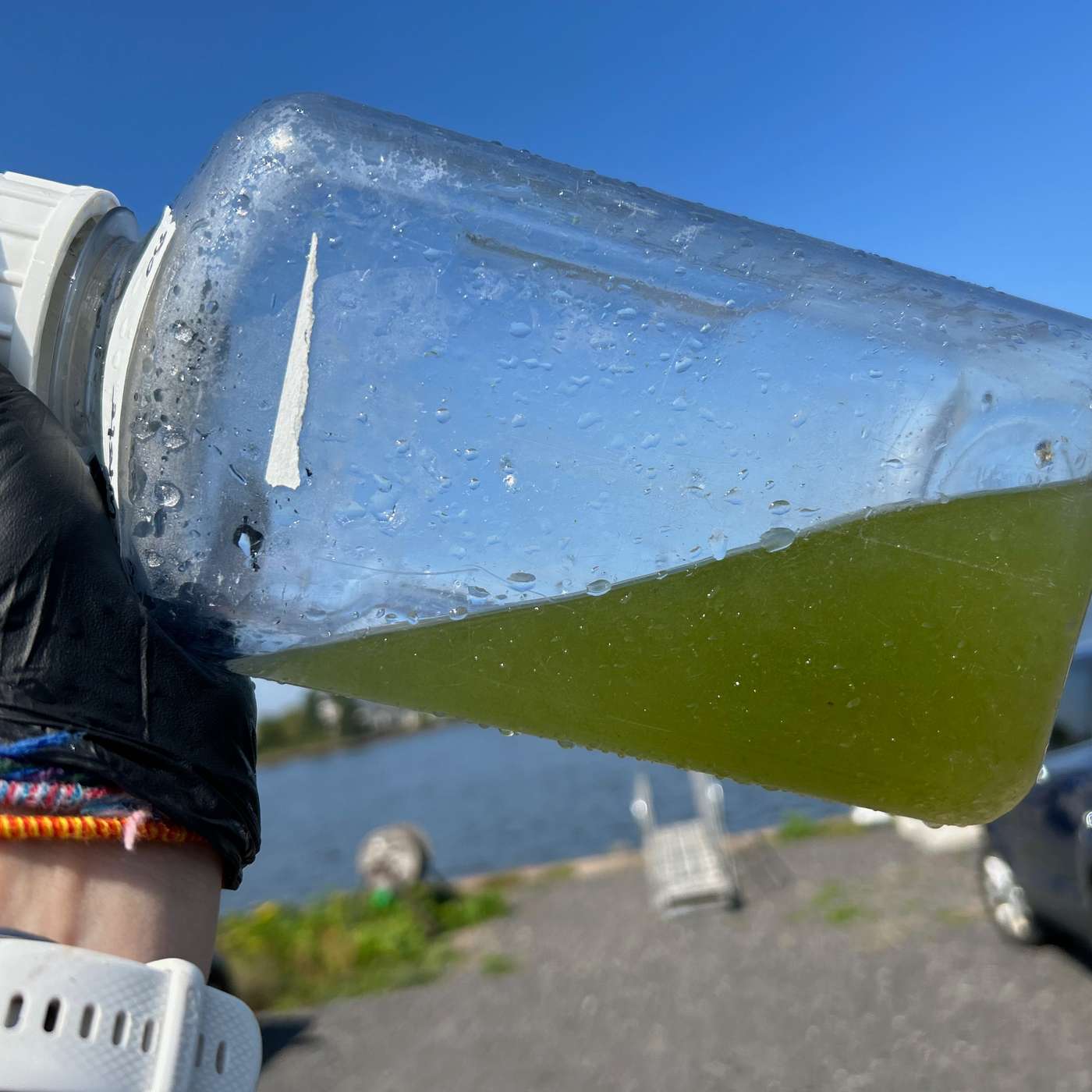 What to Know about the Northern Lakes Toxic Algae Bloom