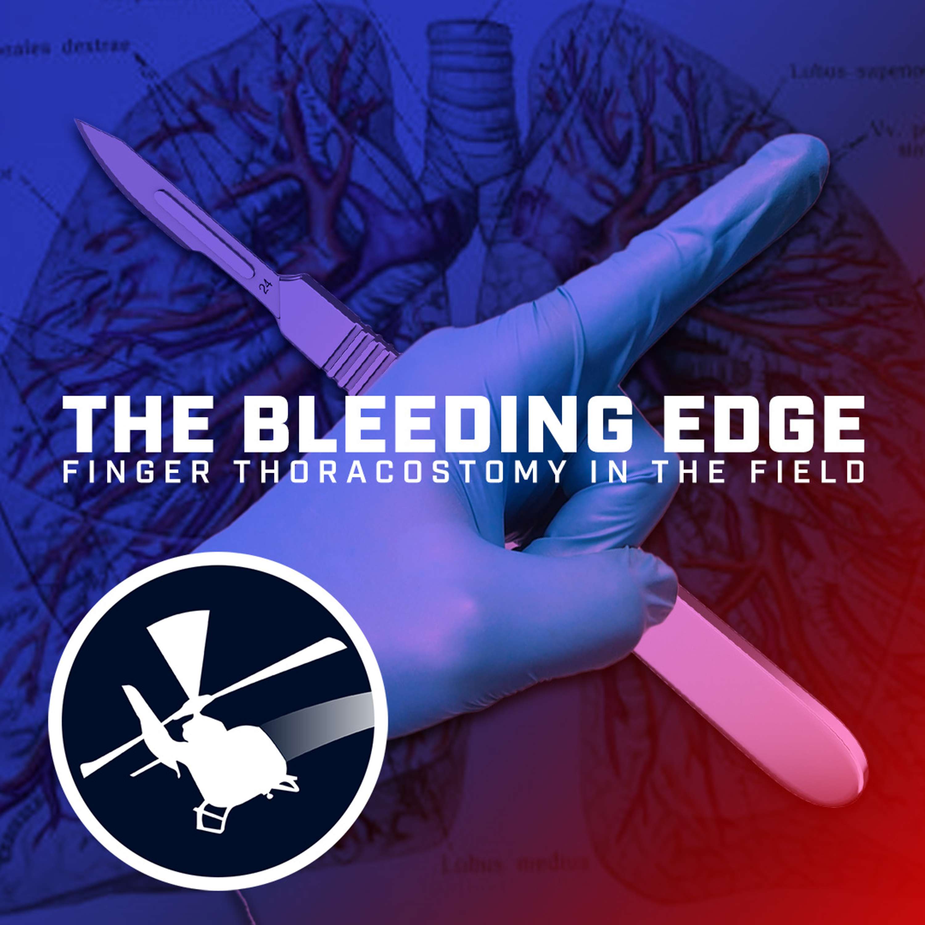 The Bleeding Edge: Finger Thoracostomy in the Field