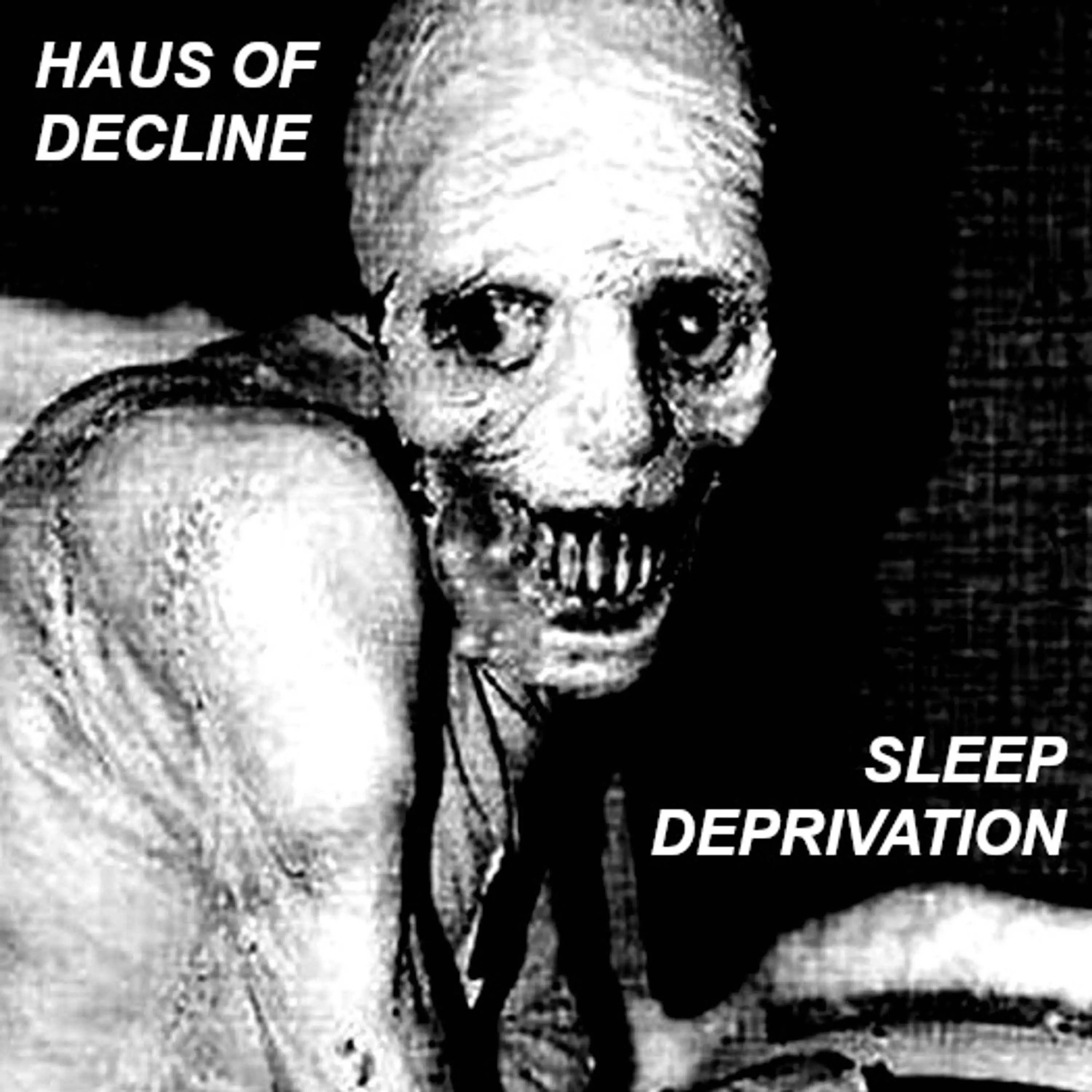 Sleep Deprivation