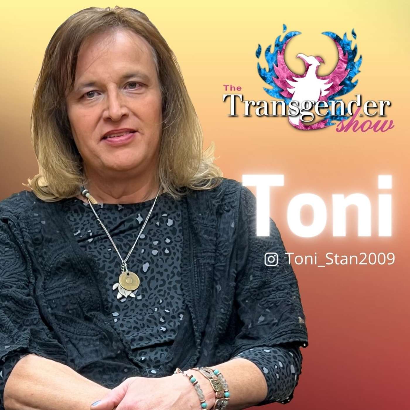 The Transgender Show