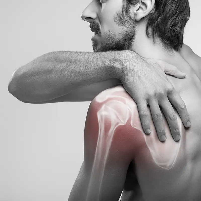 Frozen Shoulder and Other Musculoskeletal Issues 