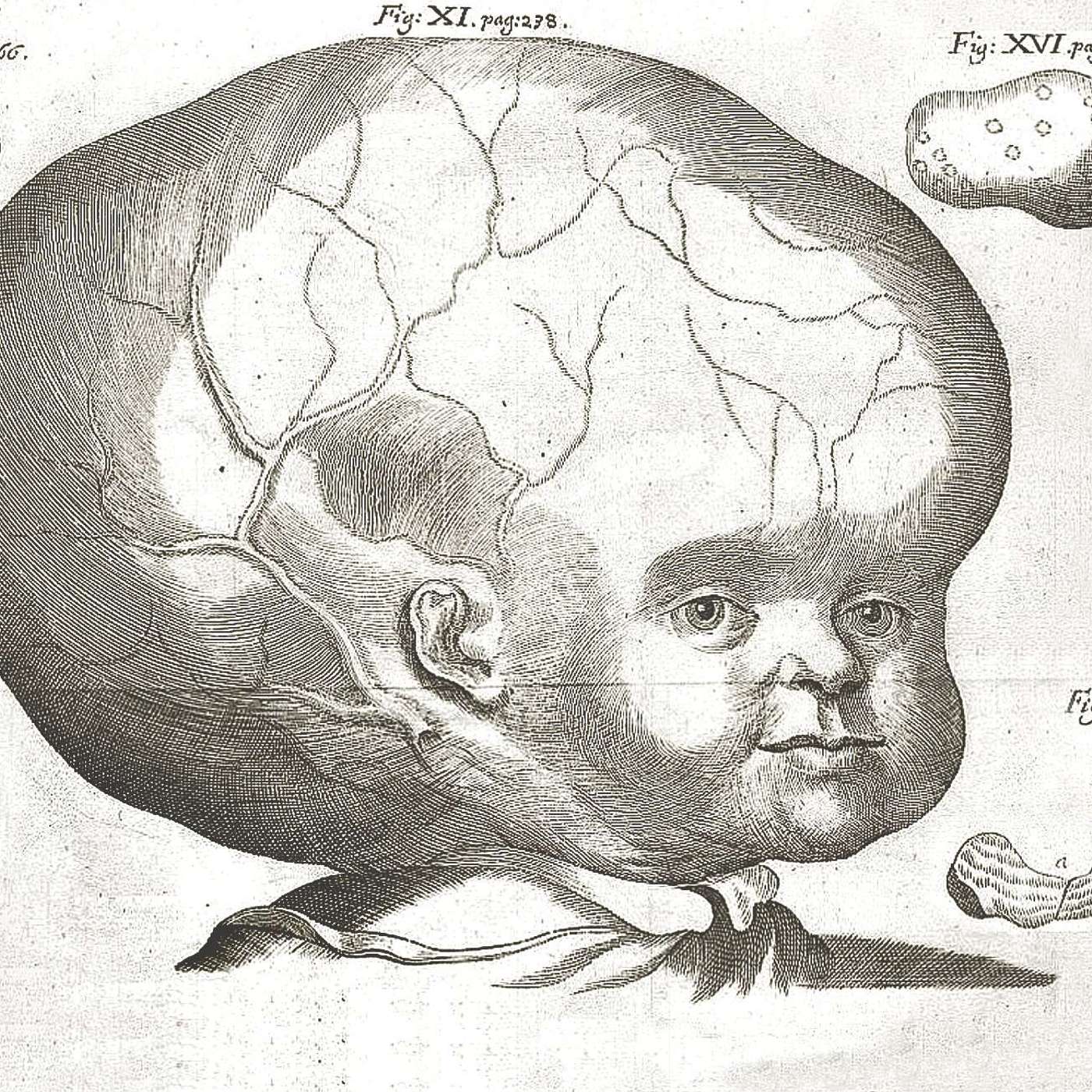 The Melonheads